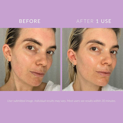 Gentle Calming Face Moisturizer for Sensitive Skin