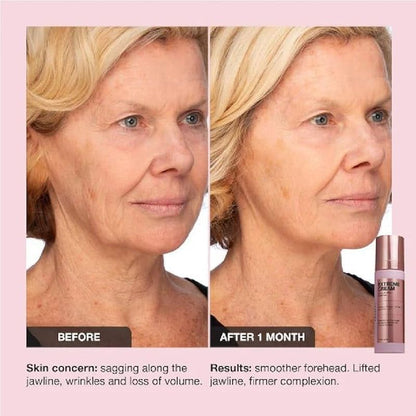 Intensive Anti Aging Face Cream Moisturizer