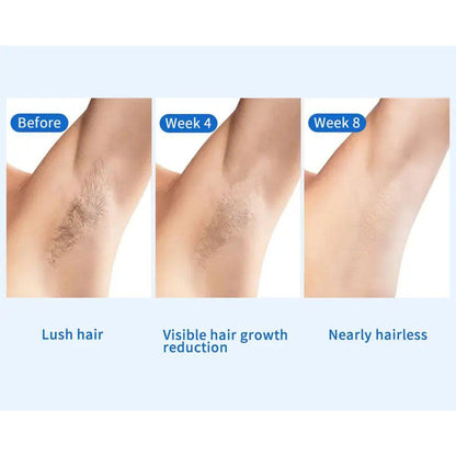 Painless At-Home Hair Remover with Cooling System