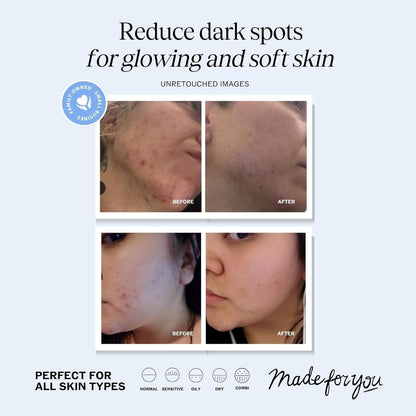Natural Vitamin C Face Serum - Brighten & Firm Skin
