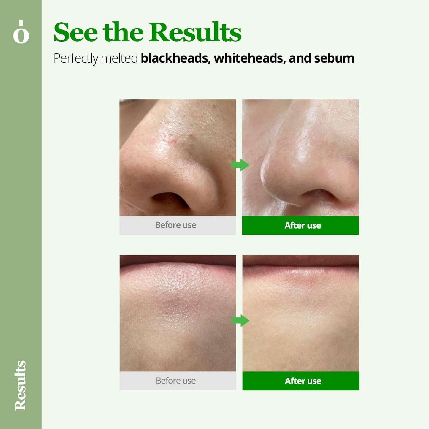 Gentle Pore Cleansing Balm 100ml