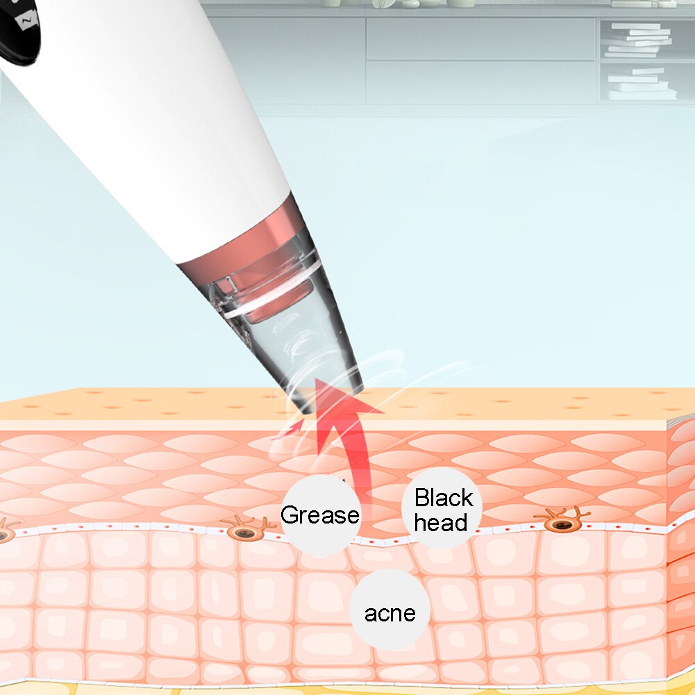 Portable Rechargeable Blackhead Vacuum Cleaner Tool