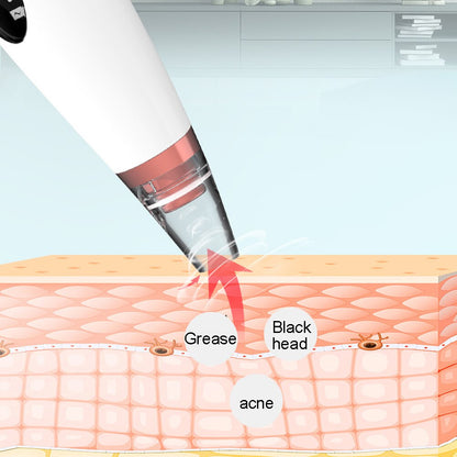 Portable Rechargeable Blackhead Vacuum Cleaner Tool