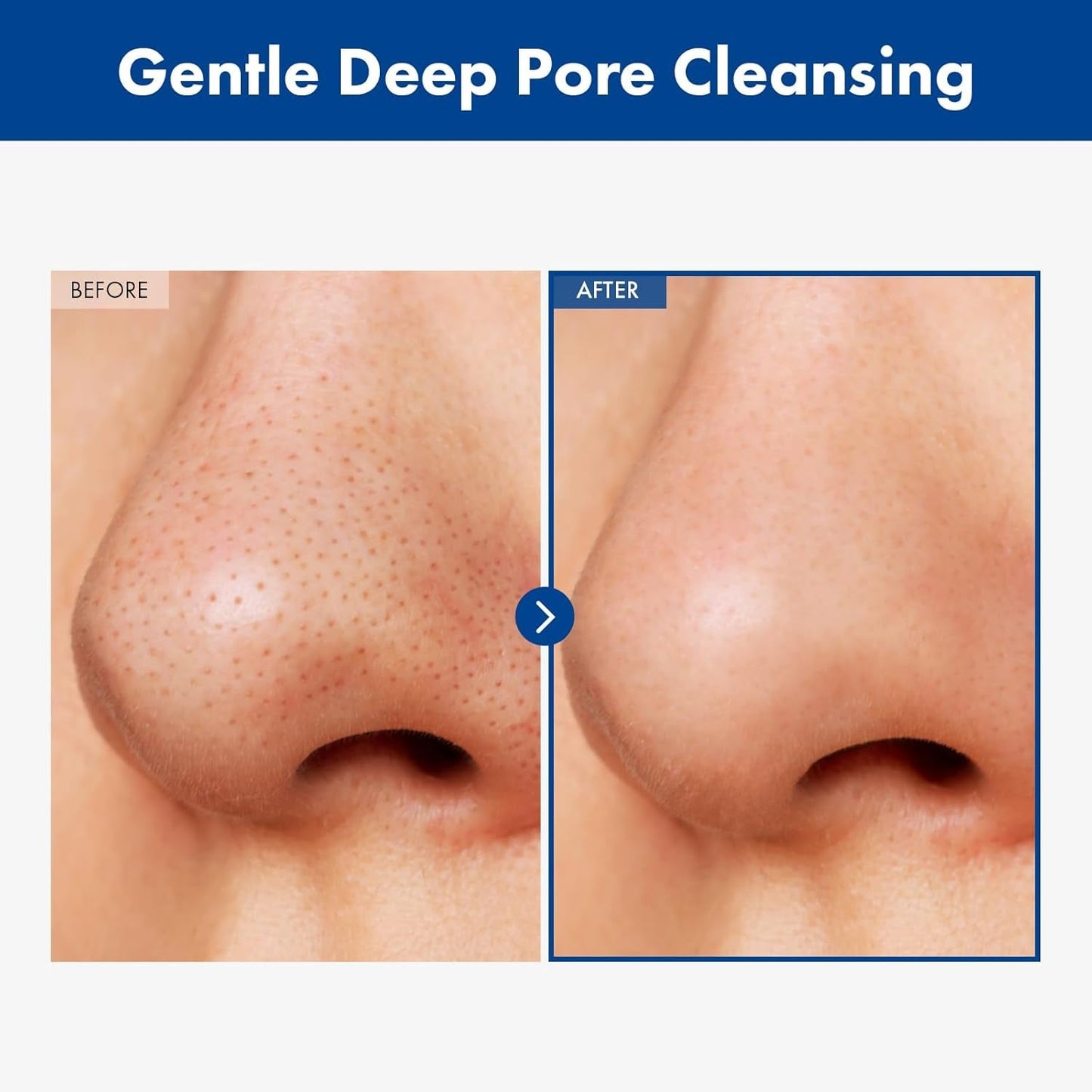 Gentle Blackhead Removal Facial Cleansing Oil