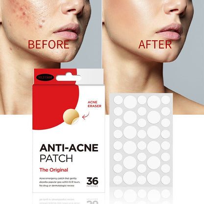 Clear Spot Treatment Pimple Patches (36 Count)