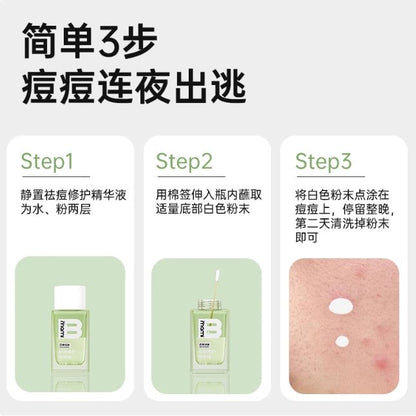 Natural Acne Treatment Serum 13ml - Spot Blemish Remedy
