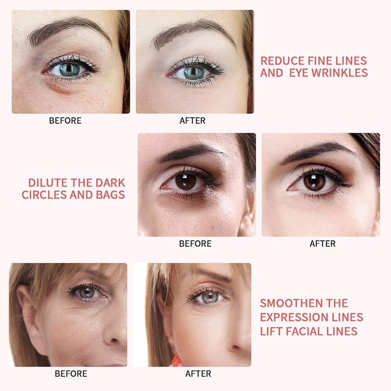 Advanced Facial Skin Tightening LED Beauty Device