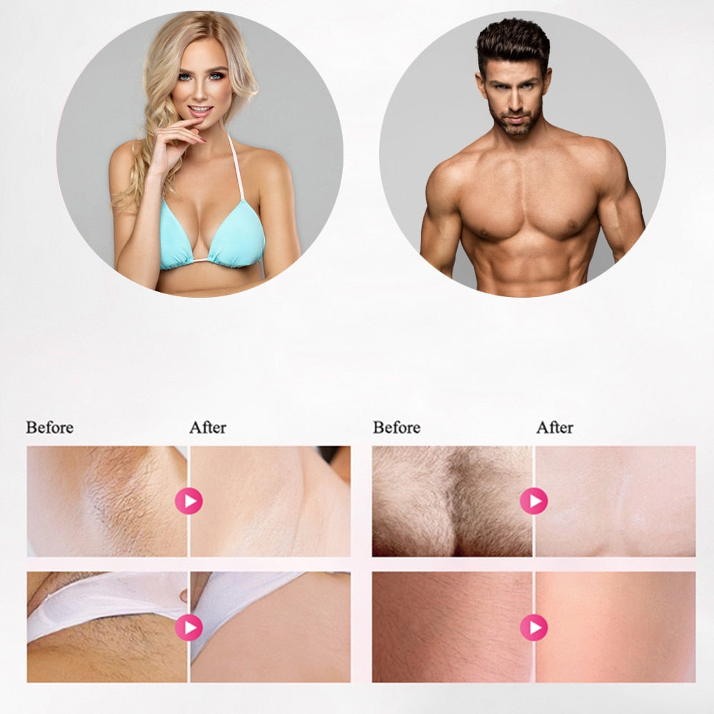 Permanent Laser Hair Remover 600k Flashes, Full Body
