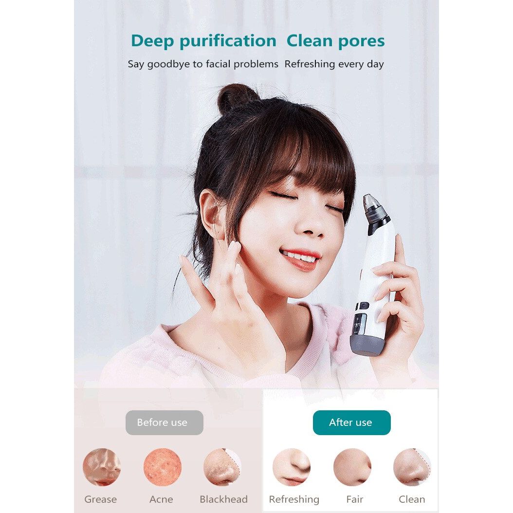Advanced Blackhead Vacuum Cleaner 3 Modes - Pore Cleanser
