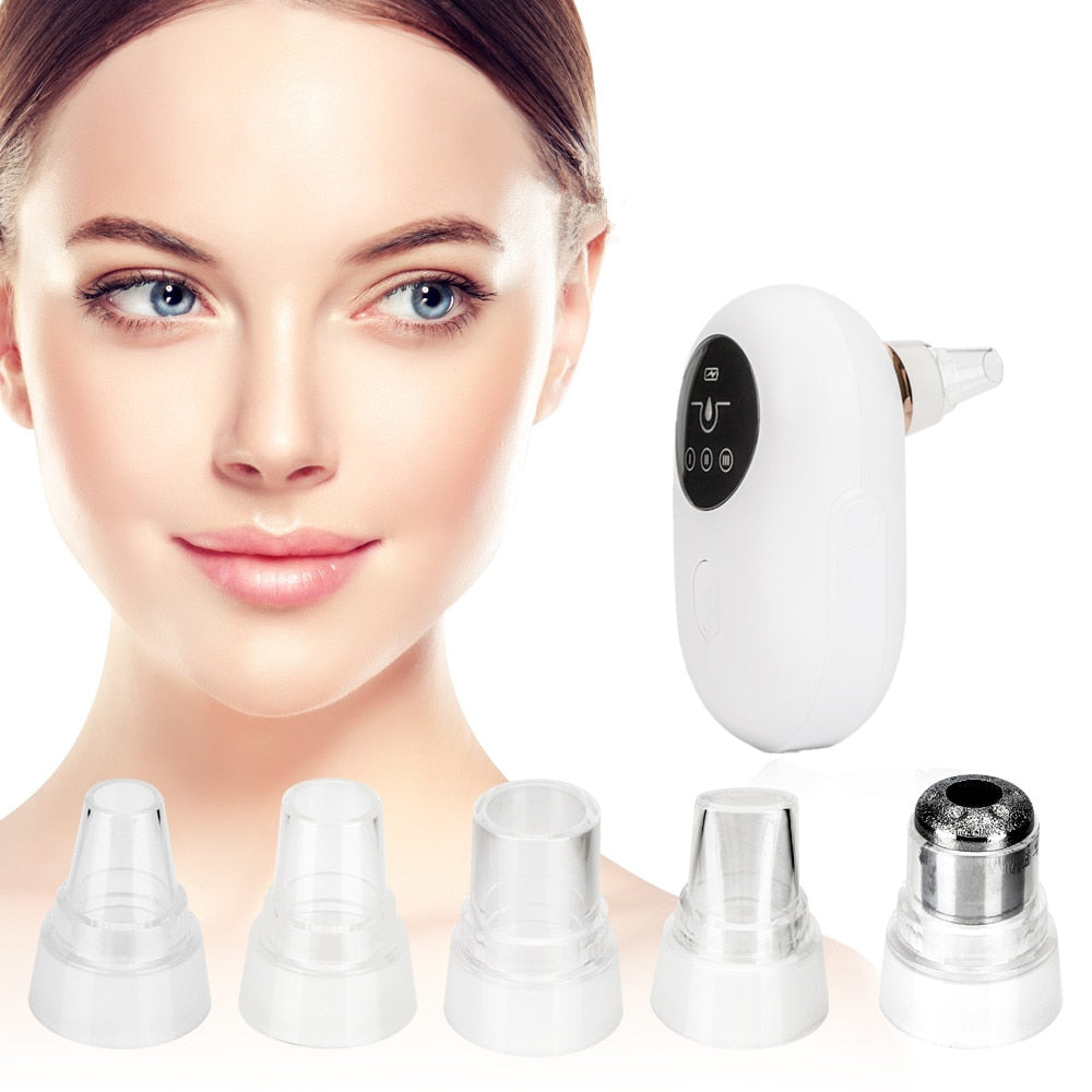 Pore Cleansing Vacuum & Exfoliating Skin Refresher Device - Mycosmeticslondon