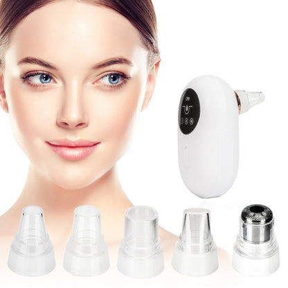 Pore Cleansing Vacuum & Exfoliating Skin Refresher Device - Mycosmeticslondon