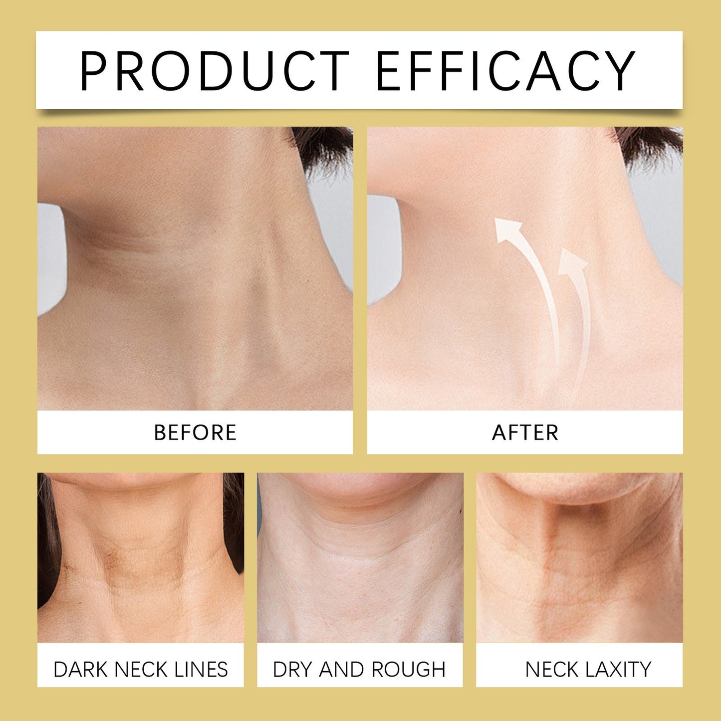 Neck Firming Peptide Cream – Tightening Formula for Neck Lines & Sagging Skin