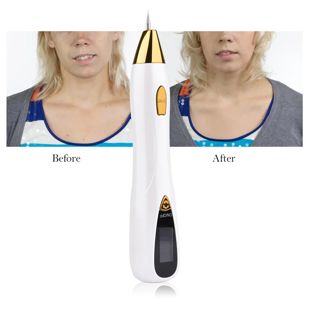 Portable Skin Spot Remover Pen for Dark Spots & Moles