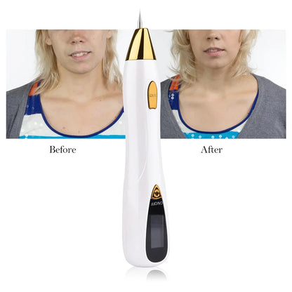 Portable Skin Spot Remover Pen for Dark Spots & Moles