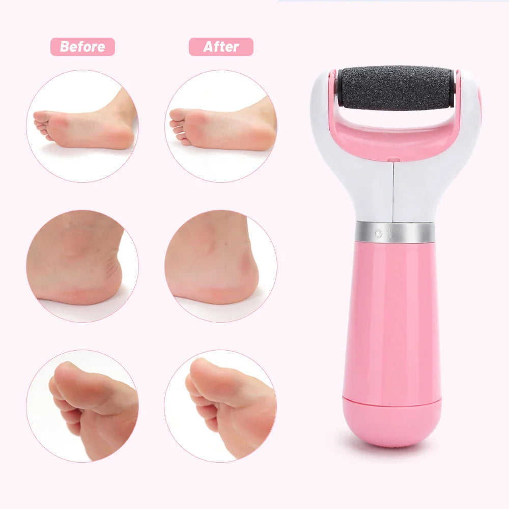 Easy to Use Electric Foot Care Kit