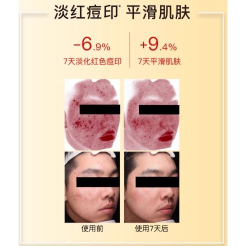 Natural Vitamin C Face Mask 10 Pack - Radiant Skin Glow
