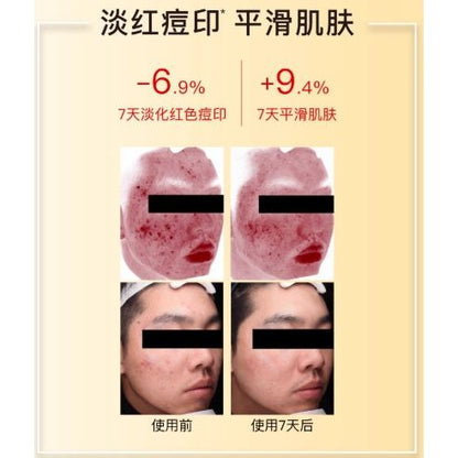 Natural Vitamin C Face Mask 10 Pack - Radiant Skin Glow
