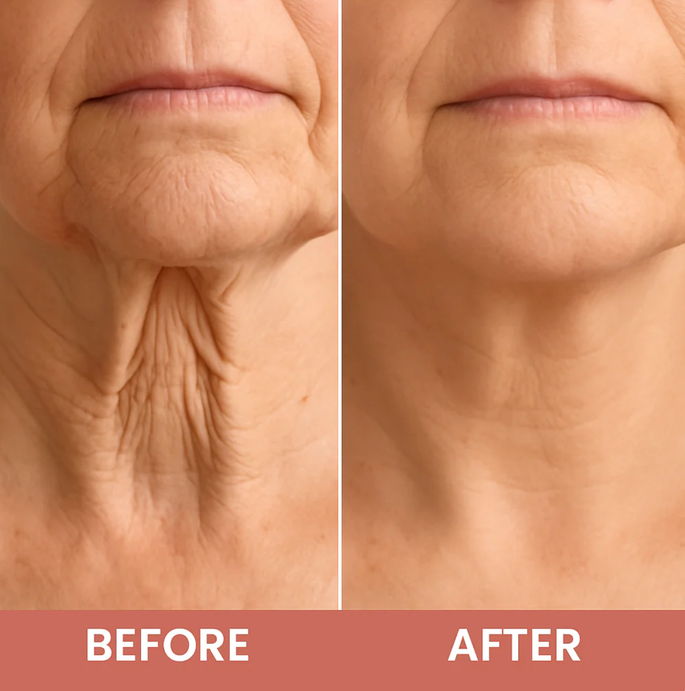 Neck Firming Peptide Cream – Tightening Formula for Neck Lines & Sagging Skin