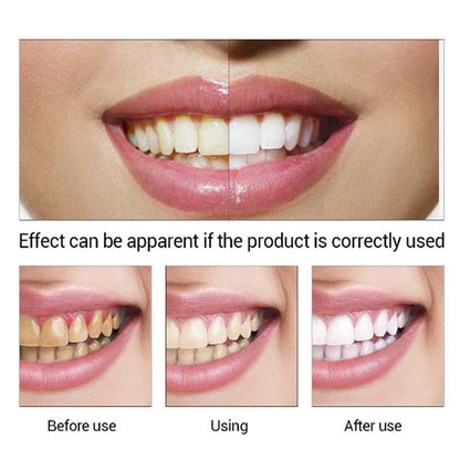 Teeth Whitening Serum Gel