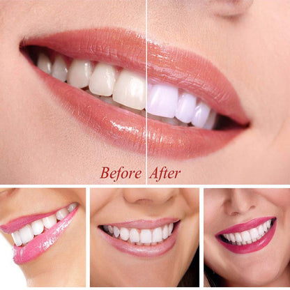 Teeth Whitening Serum Gel