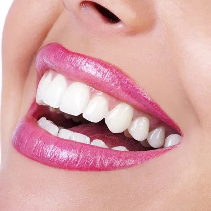 Teeth Whitening Serum Gel