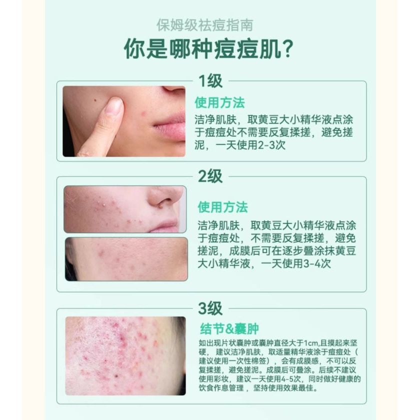Soothing Acne Serum for Sensitive Skin 15ml