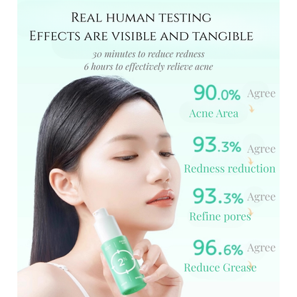 Soothing Acne Serum for Sensitive Skin 15ml
