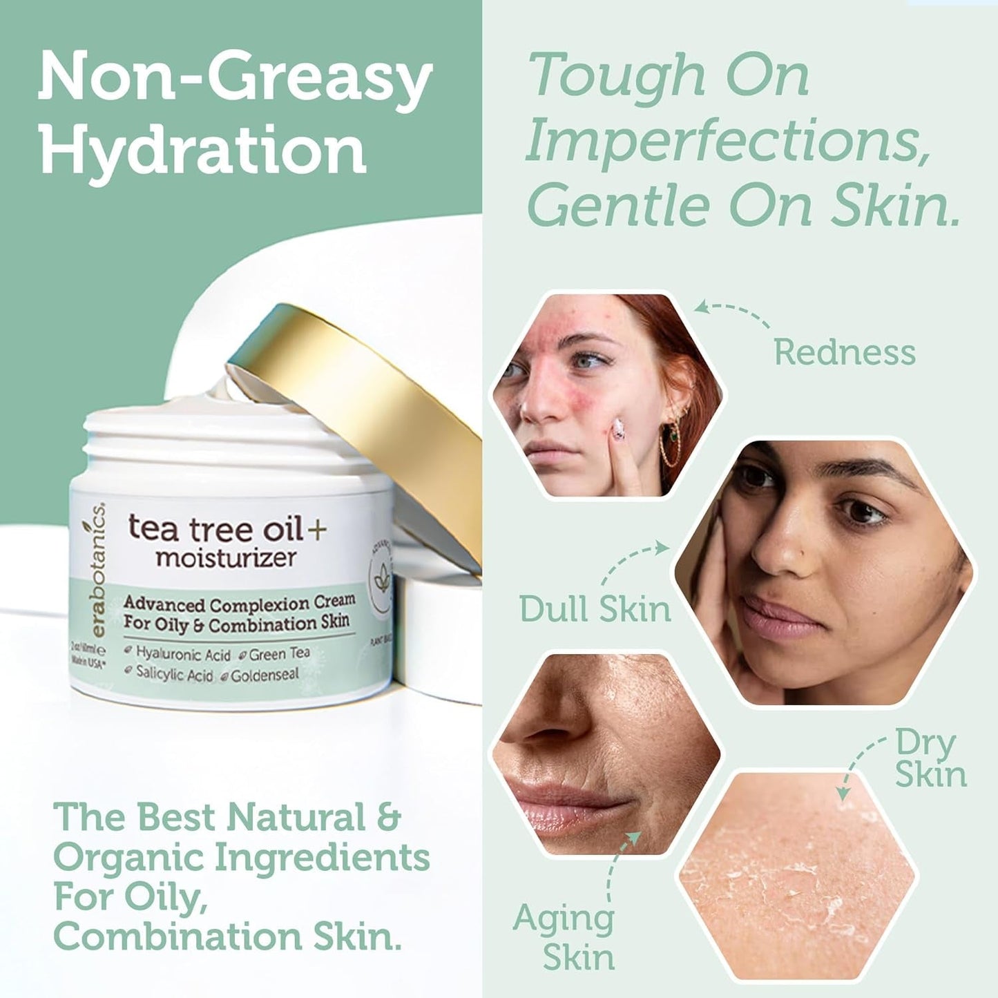 Natural Tea Tree Oil Face Cream - Acne Control Moisturizer