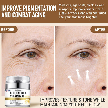 Natural Brightening Moisturizer Cream with Kojic Acid