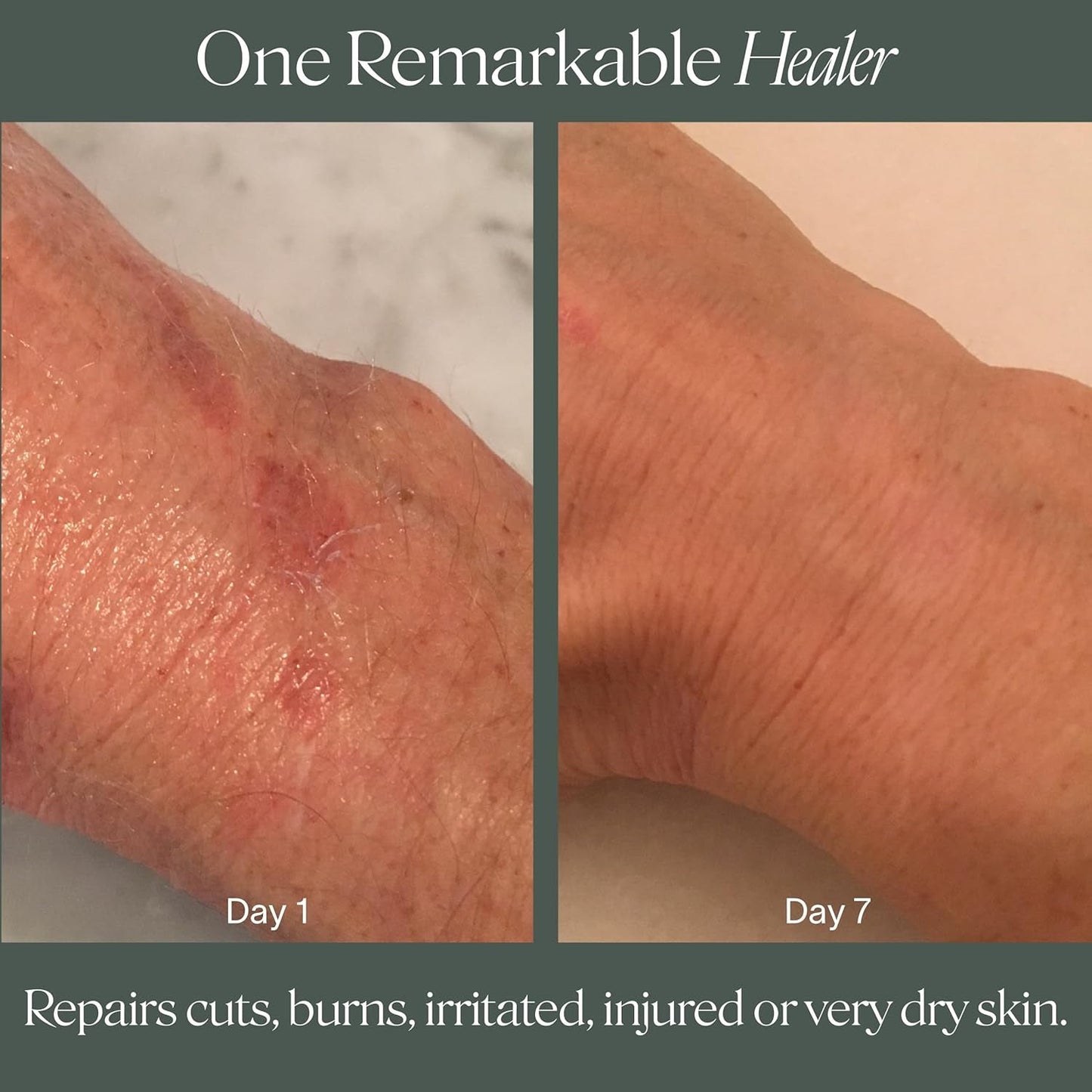 Natural Soothing Moisturizing Skin Balm