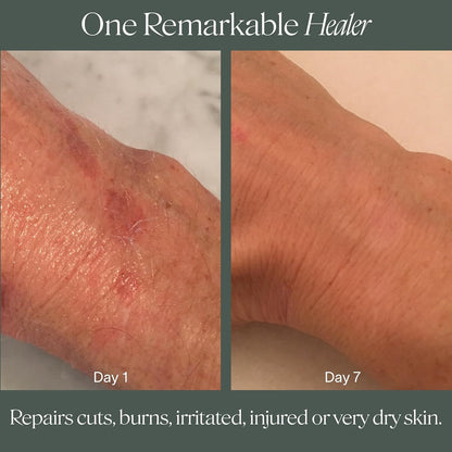 Natural Soothing Moisturizing Skin Balm
