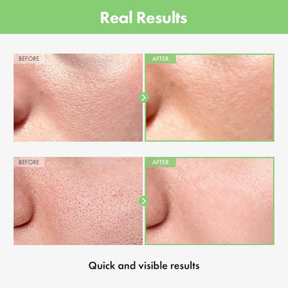 Natural Tomato Pore Serum 30ml Pore Reducing Moisturizer