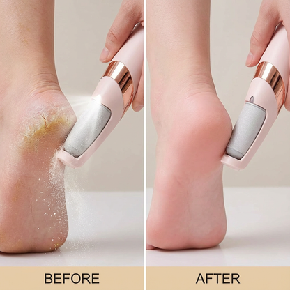 Rechargeable Electric Foot Callus Remover for Smoother Feet
