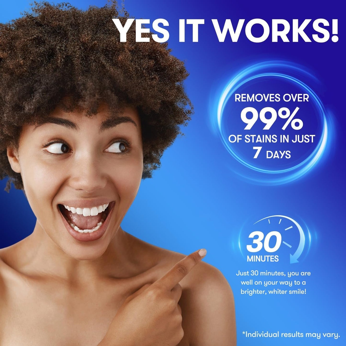 Professional At-Home Teeth Whitening Strips Kit