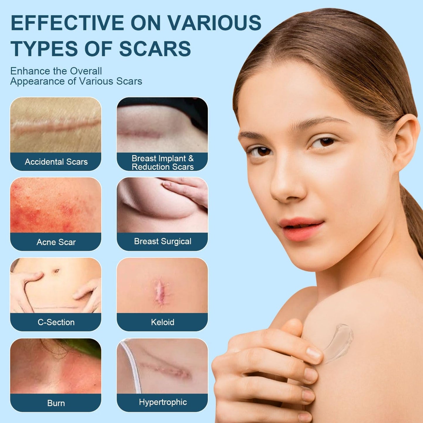 Effective Silicone Scar Cream 50ml - Fade Scars