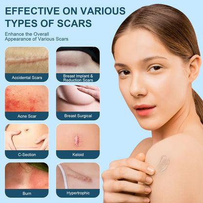 Effective Silicone Scar Cream 50ml - Fade Scars