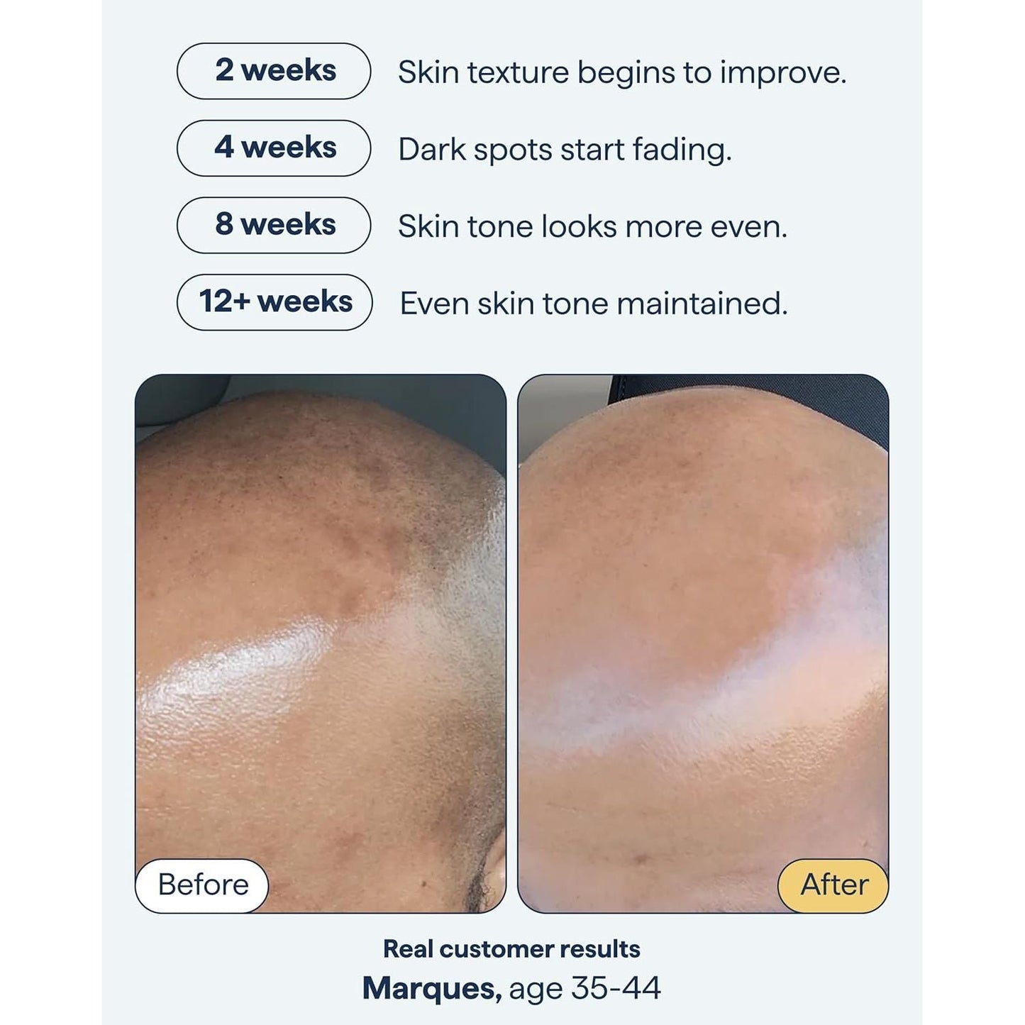 Night Time Dark Spot Corrector Serum 30ml