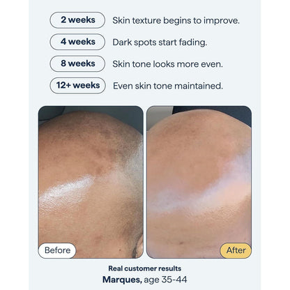 Night Time Dark Spot Corrector Serum 30ml