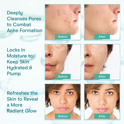 Gentle Collagen Facial Cleanser & Makeup Remover