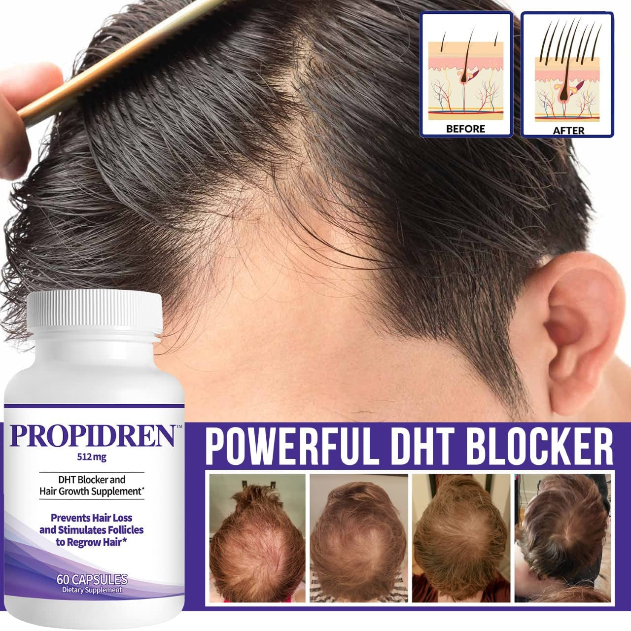 Natural Hair Growth Supplement with Biotin and Saw Palmetto
