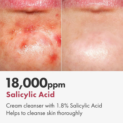 Gentle Exfoliating Face Wash 100ml - Pure Skin Cleanser