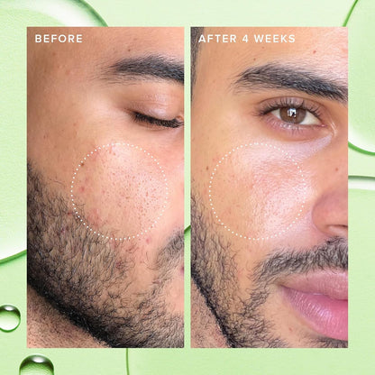 Purifying Daily Face Moisturizer 120ml