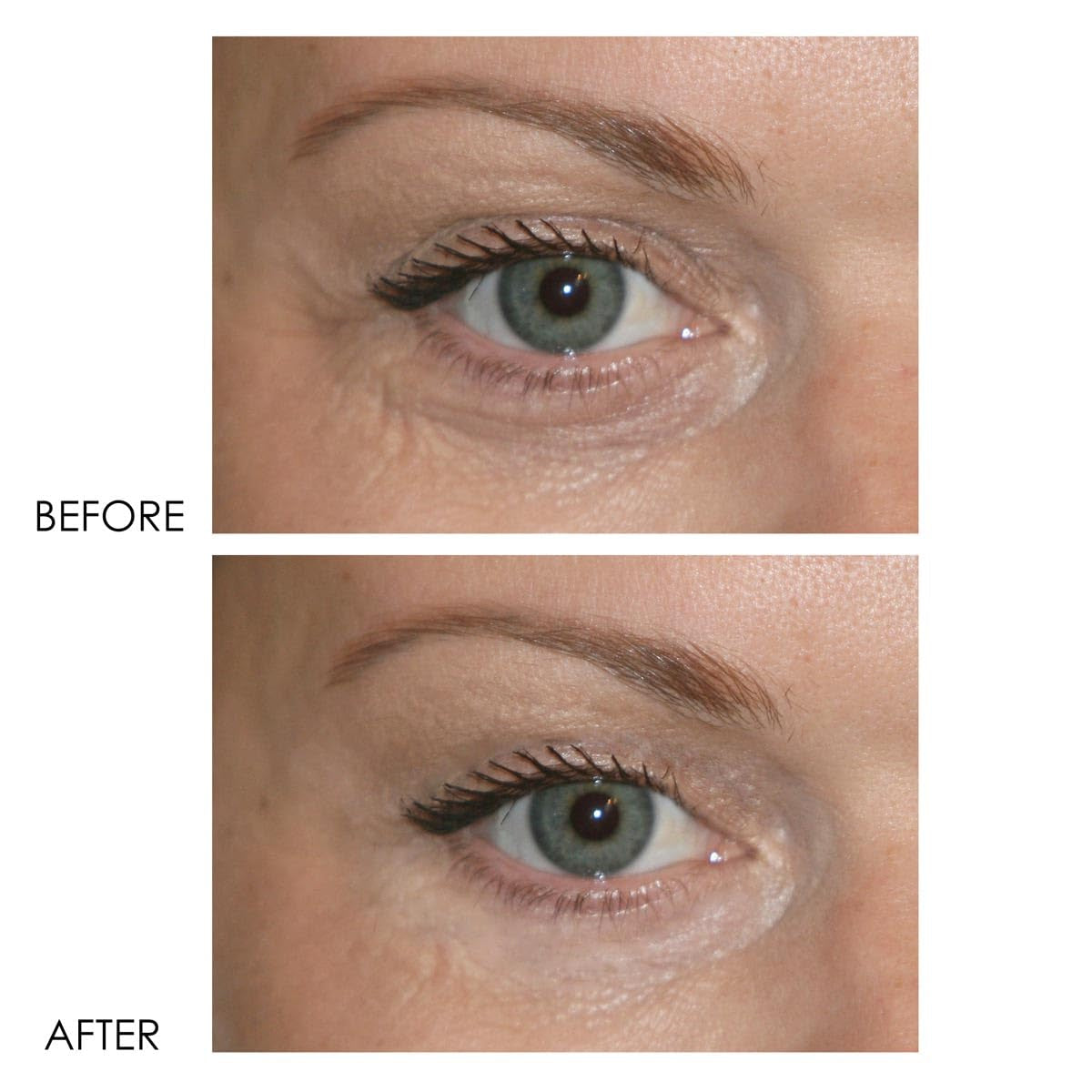 Anti Aging Eye Cream Dark Circle Reducer 15ml