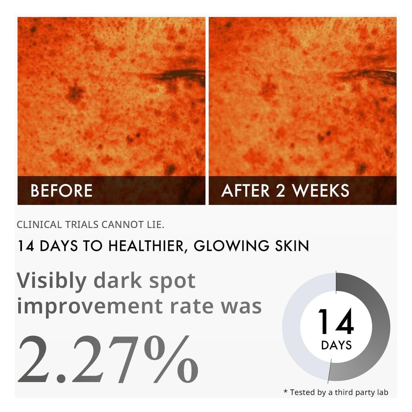 Brightening Dark Spot Serum with Niacinamide 30ml
