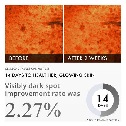 Brightening Dark Spot Serum with Niacinamide 30ml