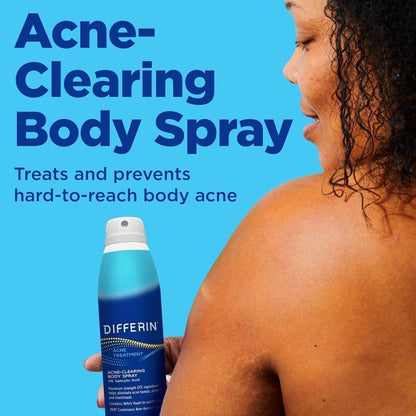 Acne Treatment Body Spray for Clear Skin - 180ml