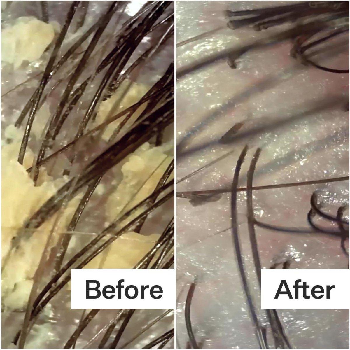 Natural Scalp Soothing Relief System
