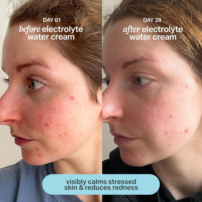 Hydrating Gel Face Cream 50ml | Refreshing Daily Moisturizer