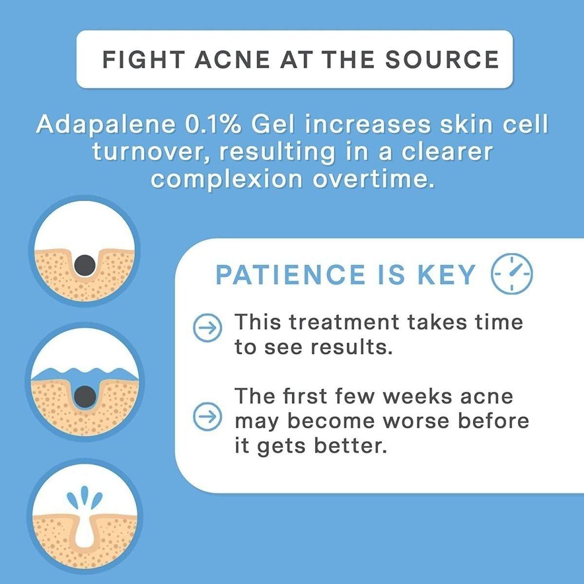 Effective Acne Treatment Gel for Clear Skin - 50ml
