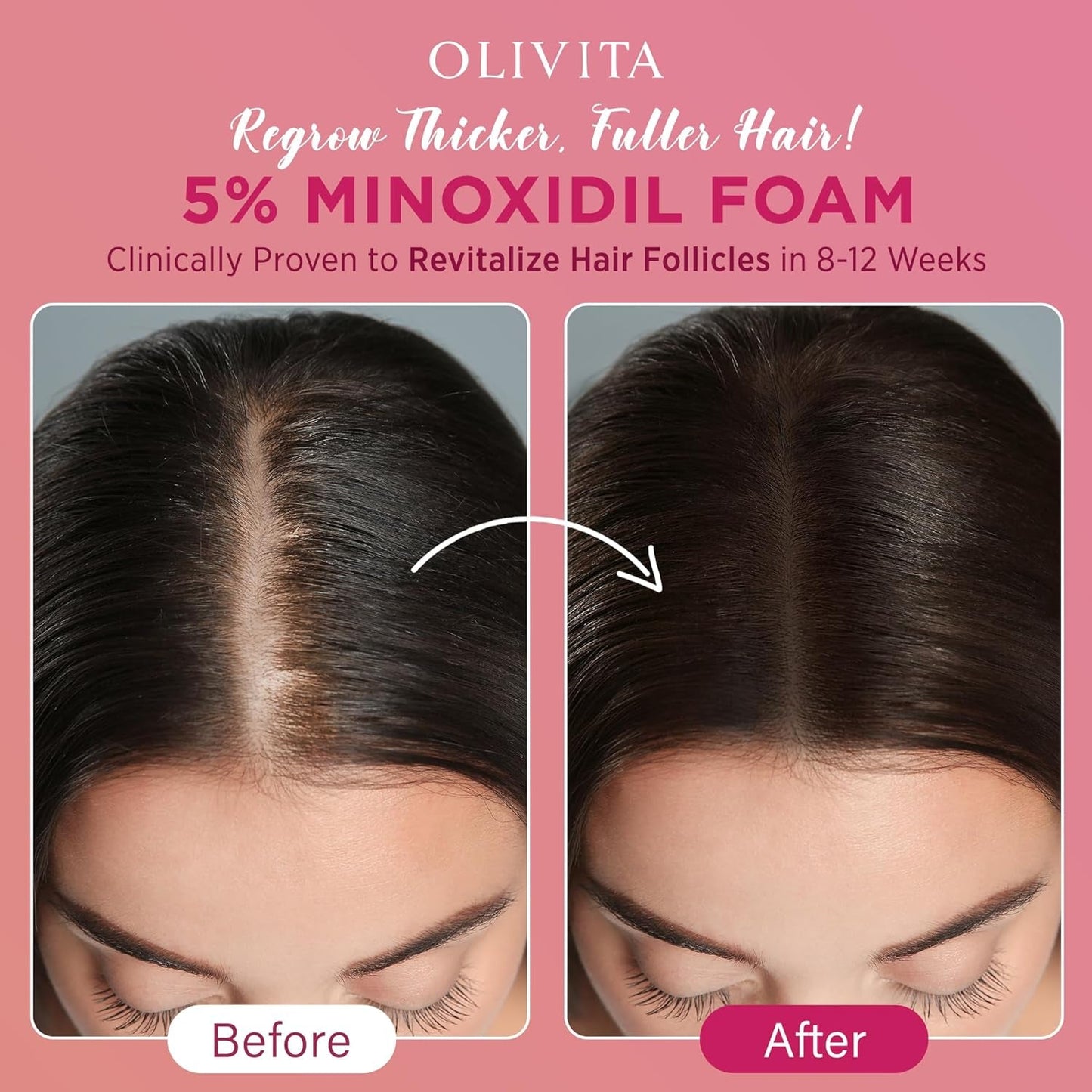 Strong Hair Growth Foam for Women - 2 x 60ml
